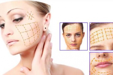 “Ma trận” công nghệ căng da chỉ vàng